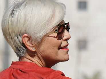 Hair Loss Post Menopause