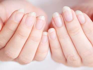 What Can Your Nails Tell You About Your Health?